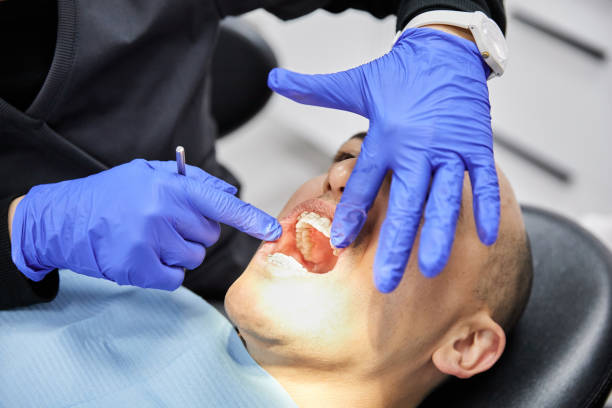 Best Broken Tooth Emergency  in Chamberlain, SD