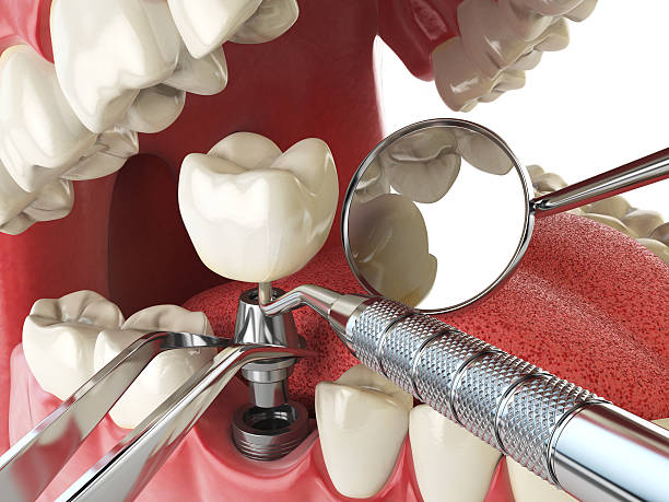 Best Root Canal Emergency Dentist  in Chamberlain, SD